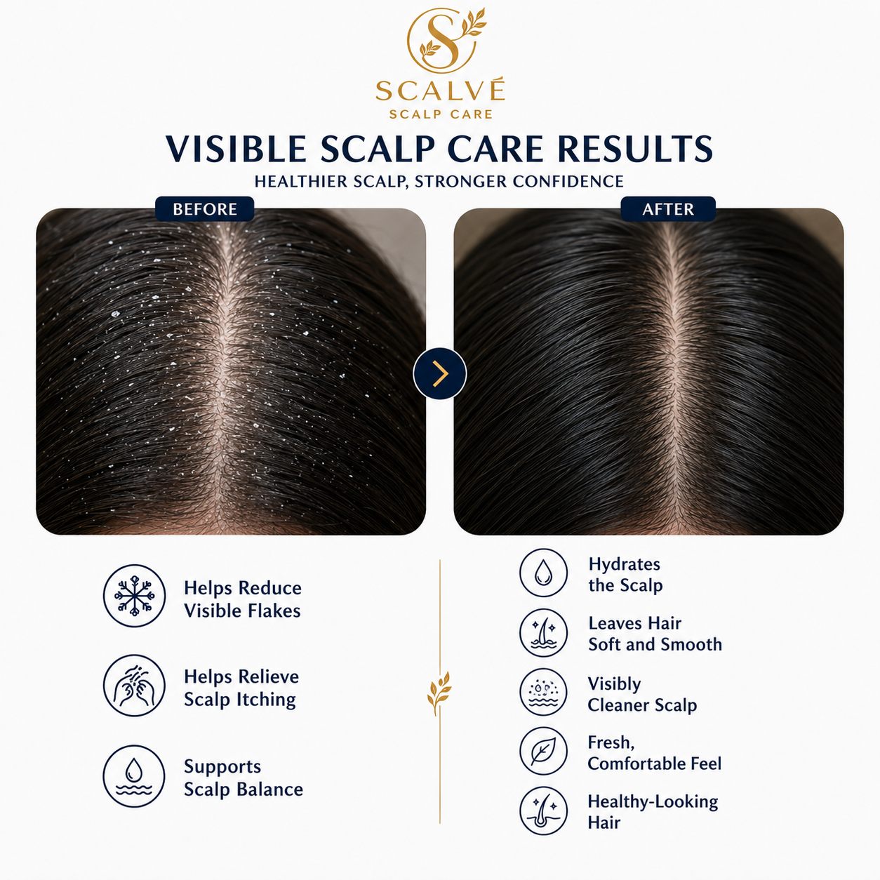 SCALVE SCALP CARE KIT